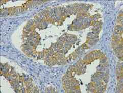 Anti-Human/Mouse/Rat CK19 Antibody [5F1]