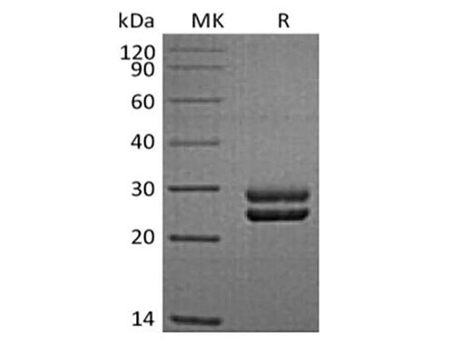 Recombinant Sheep Prolactin/PRL (C-6His) - ABMIUM
