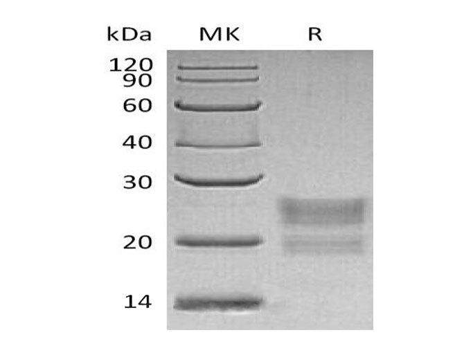 Recombinant Human MPZL1 Protein (His Tag) - ABMIUM