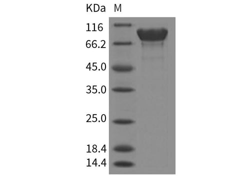 Recombinant Mouse APLP1/Amyloid-like Protein (His Tag) - ABMIUM
