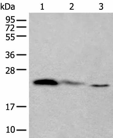 Western blot analysis of 293T and Hela cell lysates using TPT1 Polyclonal Antibody at dilution of 1:450