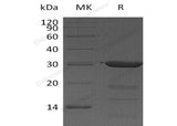 Recombinant Human FKBP3/FKBP25 Protein (His Tag) - ABMIUM