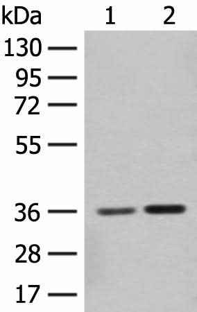 Anti-Human/Mouse/Rat SLC25A27 Antibody