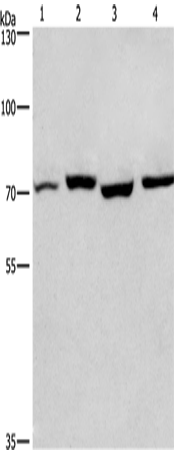 Anti-Human/Mouse/Rat ARNTL Antibody - ABMIUM