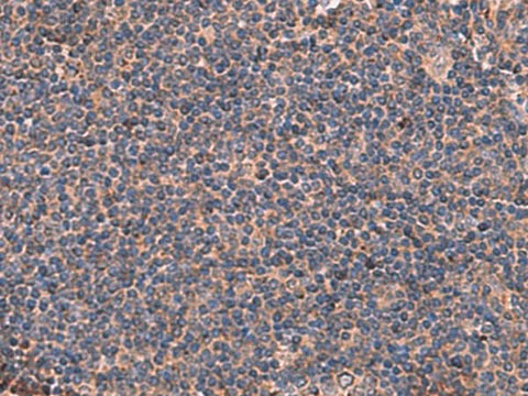 Immunohistochemistry of paraffin-embedded Human tonsil tissue using ITGA11 Polyclonal Antibody at dilution of 1:50(×200)