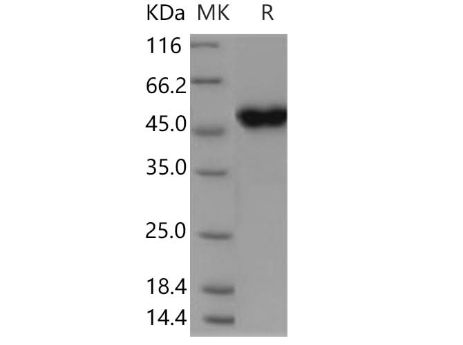 Recombinant Human CRELD1 Protein (His Tag) - ABMIUM