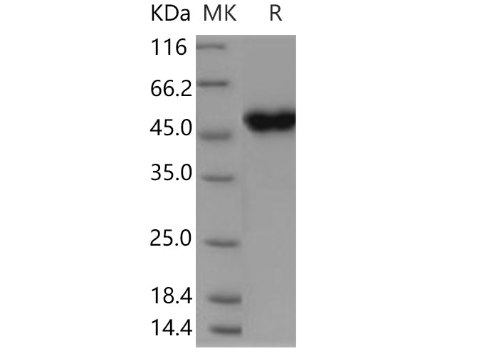 Recombinant Human CRELD1 Protein (His Tag) - ABMIUM