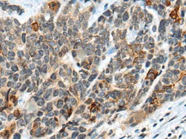 Anti-Human/Mouse ATRX Antibody