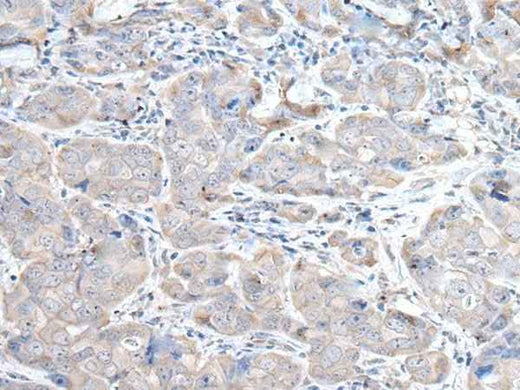 Anti-Human/Rat RASA1 Antibody