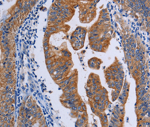 Anti-Human ACP6 Antibody - ABMIUM