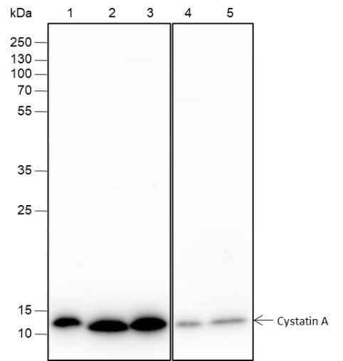 Anti-Human/Mouse Cystatin A Antibody [A204] - ABMIUM