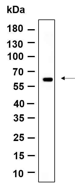 Anti-Human/Mouse/Rat Cytokeratin 10 Antibody [B917] - ABMIUM