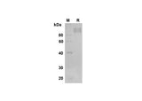 SDS-PAGE analysis of Human M-CSF R/CD115 proteins , 2 μg/lane of Recombinant Human M-CSF R/CD115 proteins was resolved with SDS-PAGE under reducing conditions , showing bands at 90 kDa.