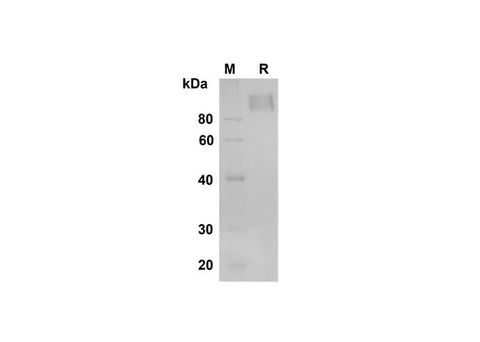 SDS-PAGE analysis of Human M-CSF R/CD115 proteins , 2 μg/lane of Recombinant Human M-CSF R/CD115 proteins was resolved with SDS-PAGE under reducing conditions , showing bands at 90 kDa.
