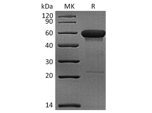 Recombinant Rhesus macaque CD160 Protein (Fc Tag) - ABMIUM