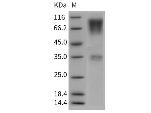 Recombinant Rat CD164/Endolyn Protein (Fc Tag) - ABMIUM
