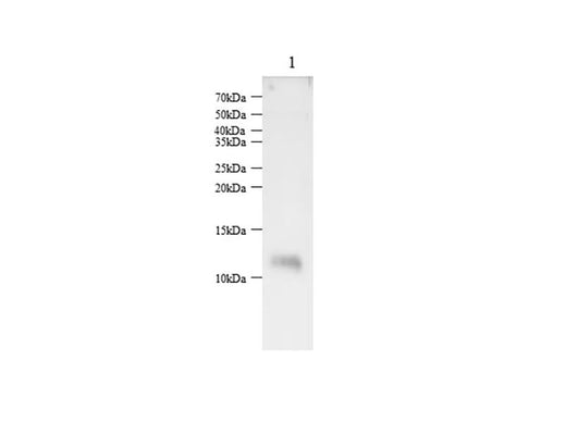 Anti-Mouse S100A1 Antibody - ABMIUM