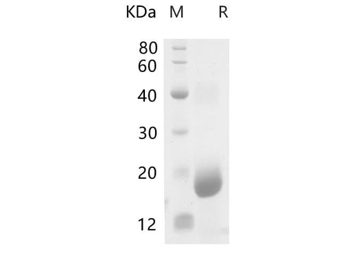 SDS-PAGE analysis of Mouse Hpgd proteins, 2 μg/lane of Recombinant Mouse Hpgd proteins was resolved with SDS-PAGE under reducing conditions, showing bands at 17-20 kDa.