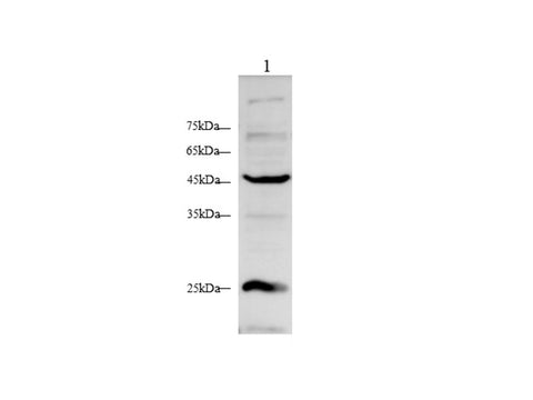 Anti-Human ACTα2 Antibody - ABMIUM