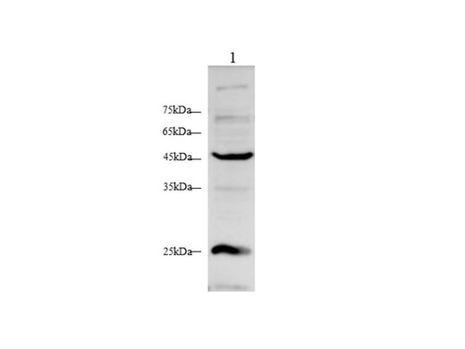 Anti-Human ACTα2 Antibody - ABMIUM