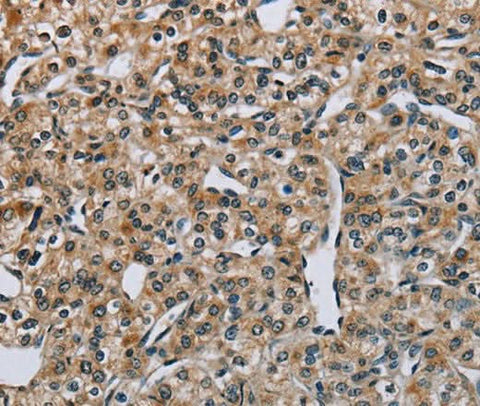 Anti-Human/Mouse PNPT1 Antibody - ABMIUM