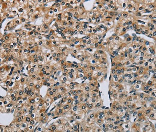 Anti-Human/Mouse PNPT1 Antibody - ABMIUM