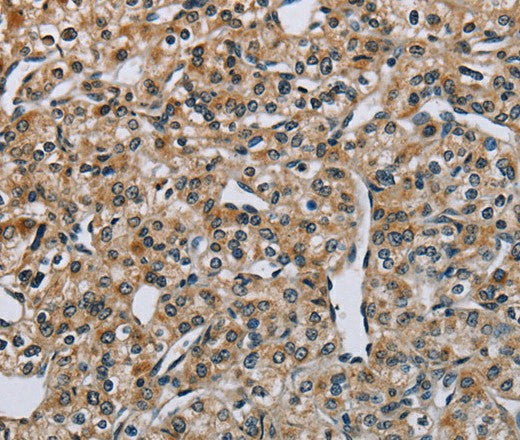 Anti-Human/Mouse PNPT1 Antibody - ABMIUM