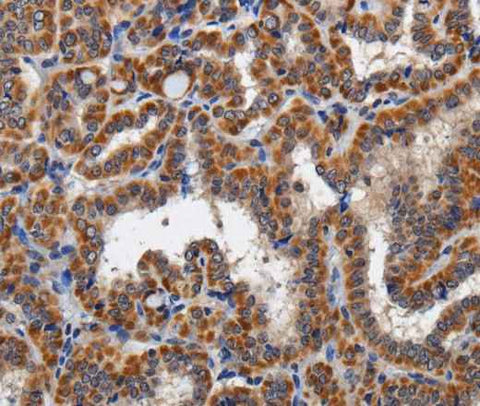 Anti-Human KLK6 Antibody