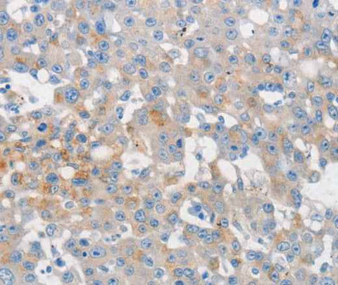 Anti-Human MUC5AC Antibody