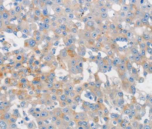 Anti-Human MUC5AC Antibody