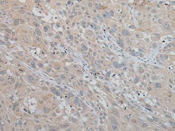 Anti-Human MLANA Antibody