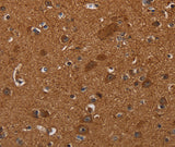 Anti-Human/Mouse CYBB Antibody - ABMIUM