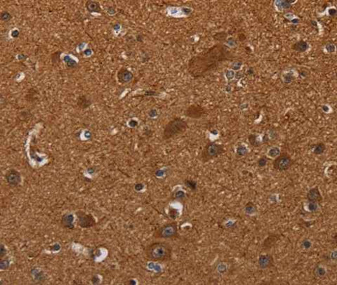 Anti-Human/Mouse CYBB Antibody