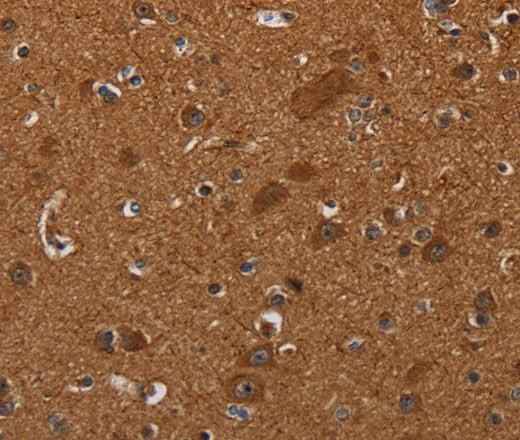 Anti-Human/Mouse CYBB Antibody