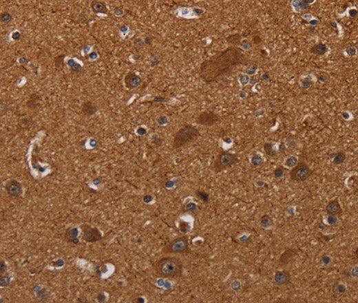 Anti-Human/Mouse CYBB Antibody - ABMIUM