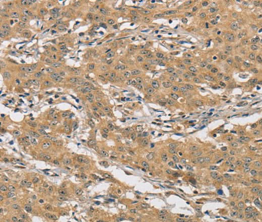 Anti-Human AMZ2 Antibody - ABMIUM