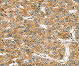Anti-Human/Mouse/Rat RASSF9 Antibody - ABMIUM