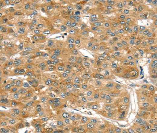 Anti-Human/Mouse/Rat RASSF9 Antibody