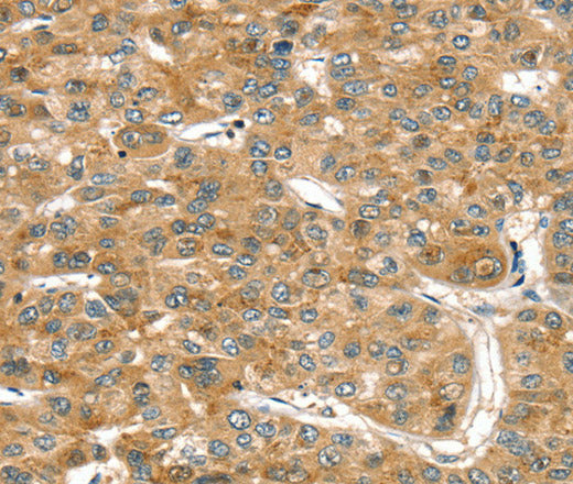 Anti-Human/Mouse/Rat RASSF9 Antibody - ABMIUM