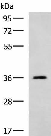 Western blot analysis of Human cerebella tissue lysate using ATP1B2 Polyclonal Antibody at dilution of 1:650