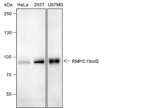 Anti-Human RMP/C19orf2 Antibody [A386] - ABMIUM