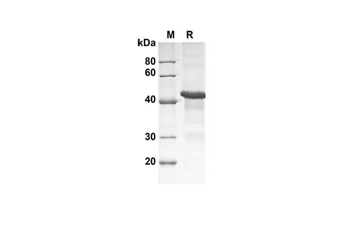 SDS-PAGE analysis of Human DKK-4 proteins , 2 μg/lane of Recombinant Human DKK-4 proteins was resolved with SDS-PAGE under reducing conditions , showing bands at 43 kDa.