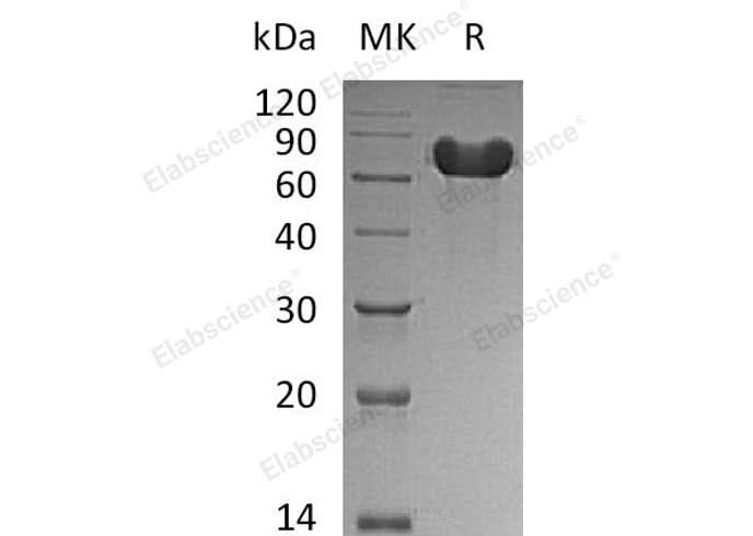 Recombinant Human GOLPH2/GOLM1 Protein (aa 40-401, His Tag) - ABMIUM