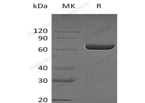 Recombinant Human LTA4H Protein (His Tag) - ABMIUM