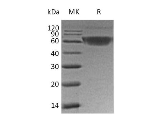 Recombinant Human PD-1/PDCD1 Protein (mFc Tag) - ABMIUM