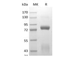 Recombinant Human Hepatocyte Growth Factor Receptor/HGF R/cMet (C-6His-Avi) Biotinylated - ABMIUM