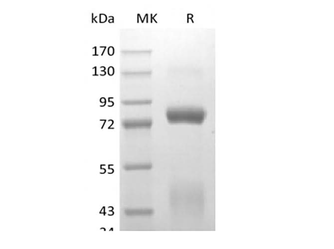 Recombinant Human Hepatocyte Growth Factor Receptor/HGF R/cMet (C-6His-Avi) Biotinylated - ABMIUM