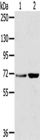 Anti-Human/Mouse SNX2 Antibody - ABMIUM