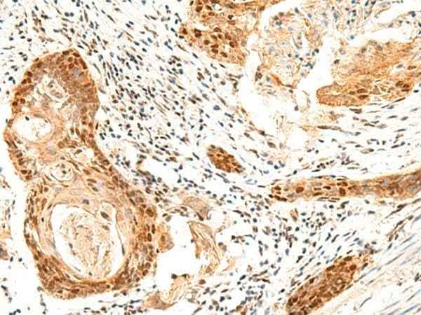 Anti-Human/Mouse SETMAR Antibody