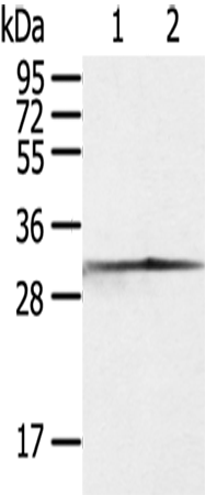 Anti-Human/Mouse/Rat CASP3 Antibody - ABMIUM
